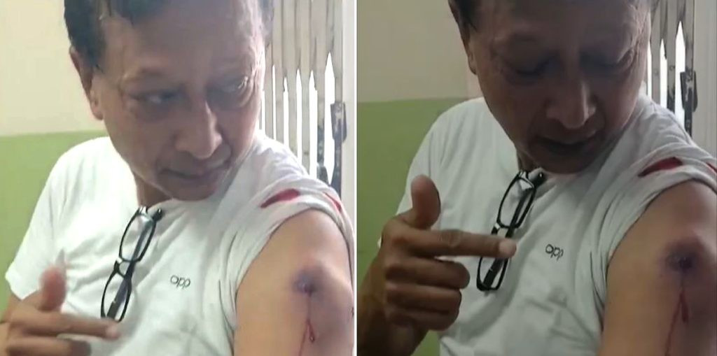 "नयाँबानेश्वर प्रदर्शनमा कान्तिपुर टिभीका पत्रकार श्याम श्रेष्ठ घाइते"